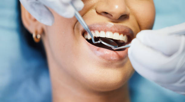 Best Emergency Dental Care for Broken or Chipped Teeth in Ripon, CA